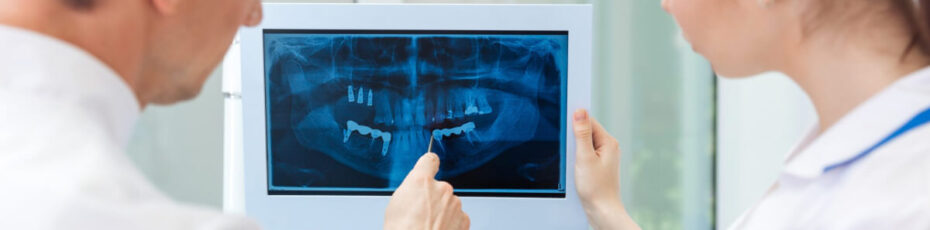 are digital dental x-rays important