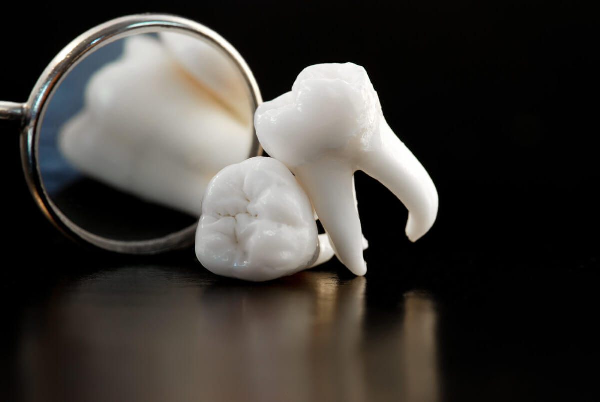 is it wise to settle for a tooth extraction for a damaged tooth