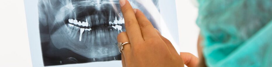 why should you consider different types of dental x-rays