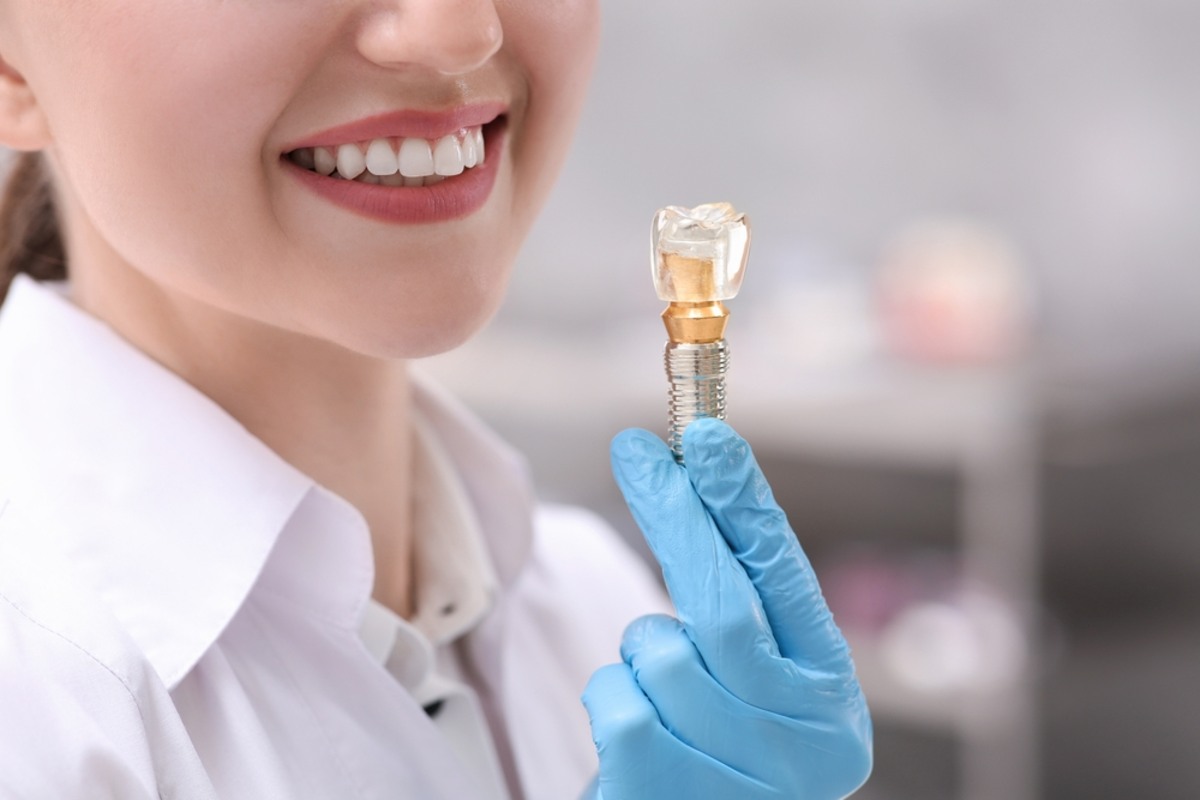 why dental implants are the best solution for missing teeth